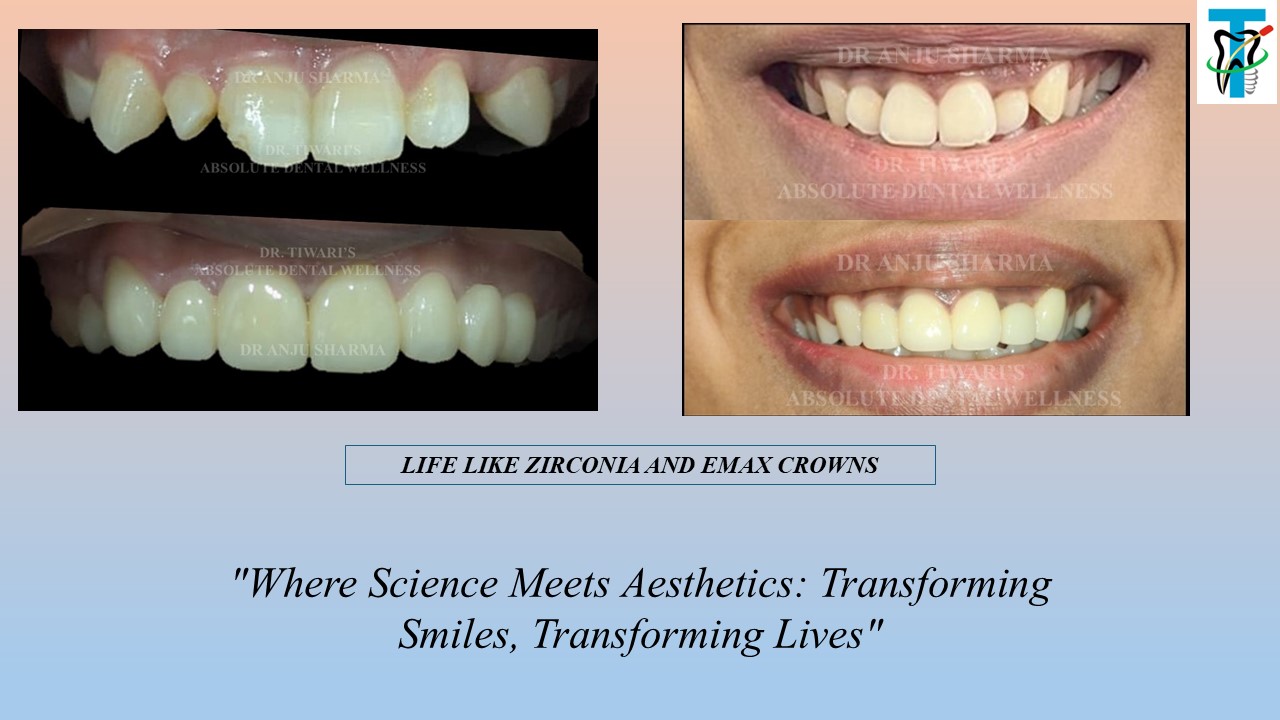 Before & After Clinical Case 1