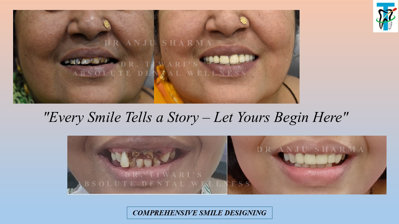 Before & After Clinical Case 3