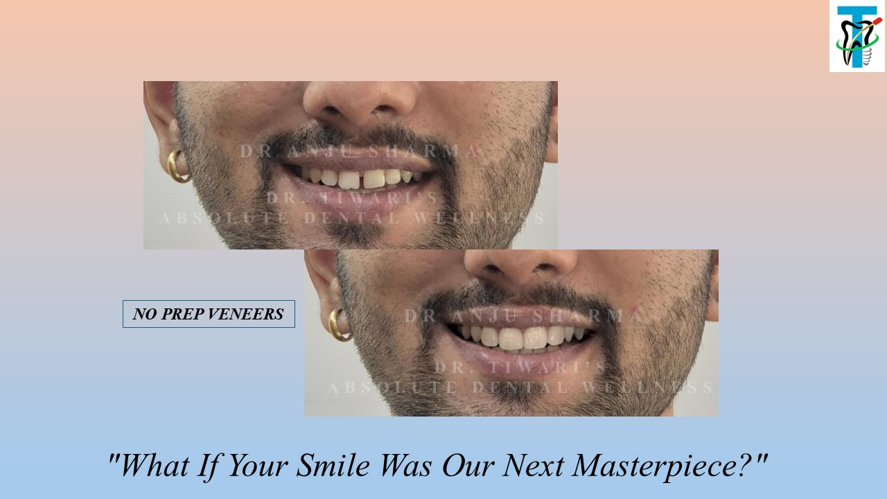 Before & After Clinical Case 4