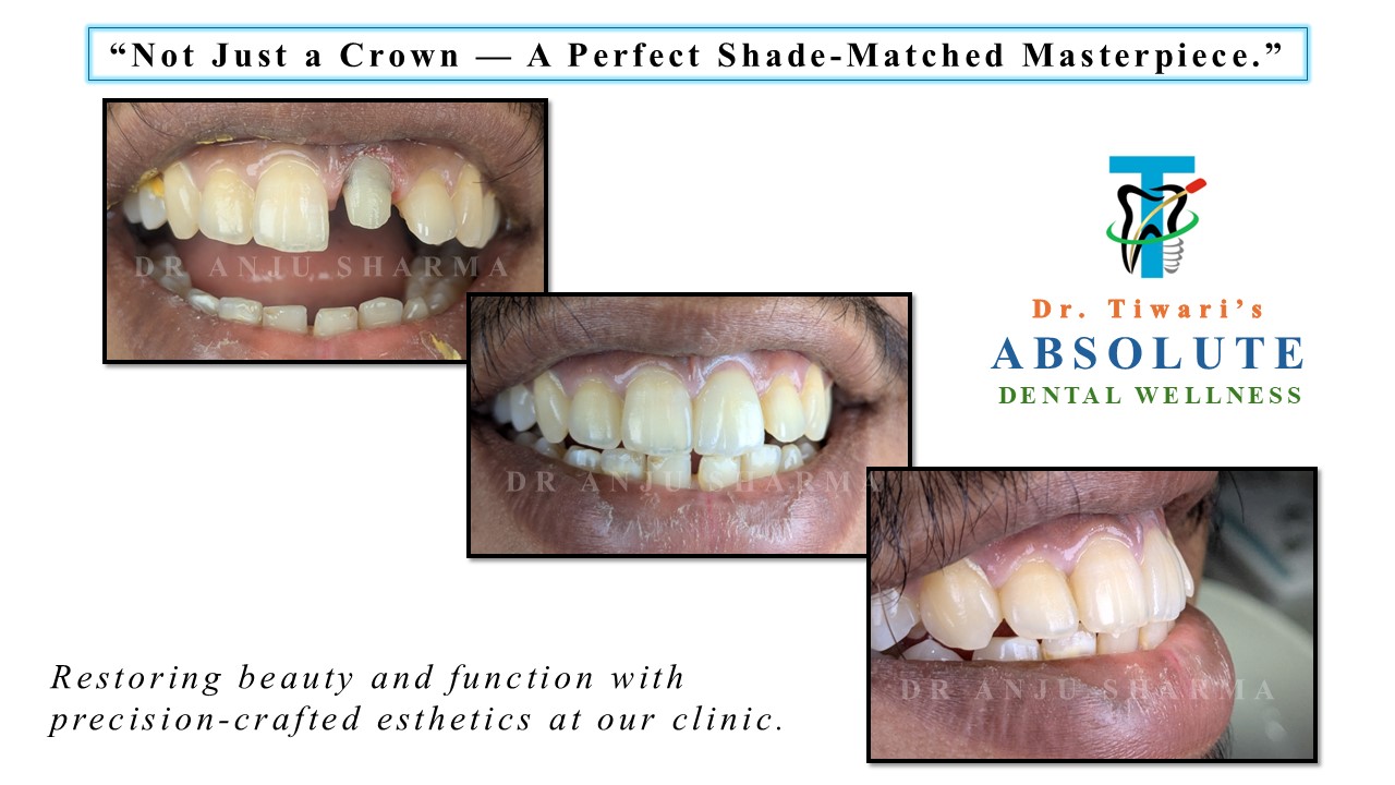 Before & After Clinical Case 5