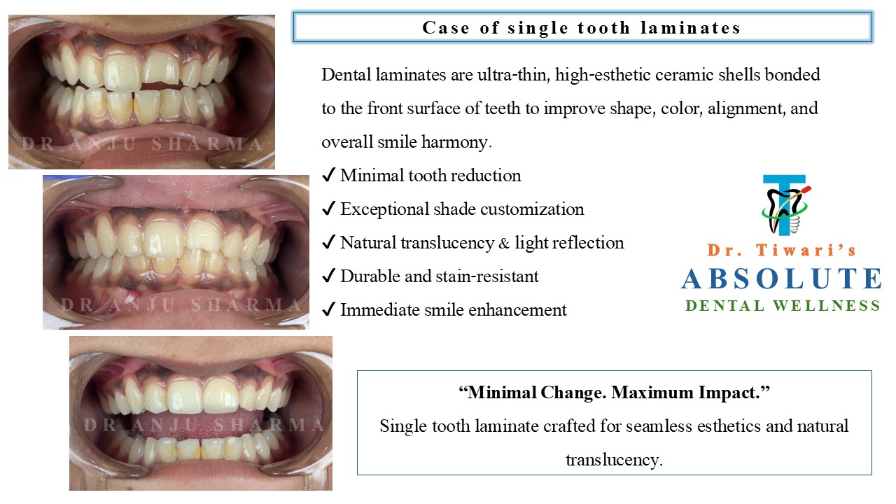 Before & After Clinical Case 6
