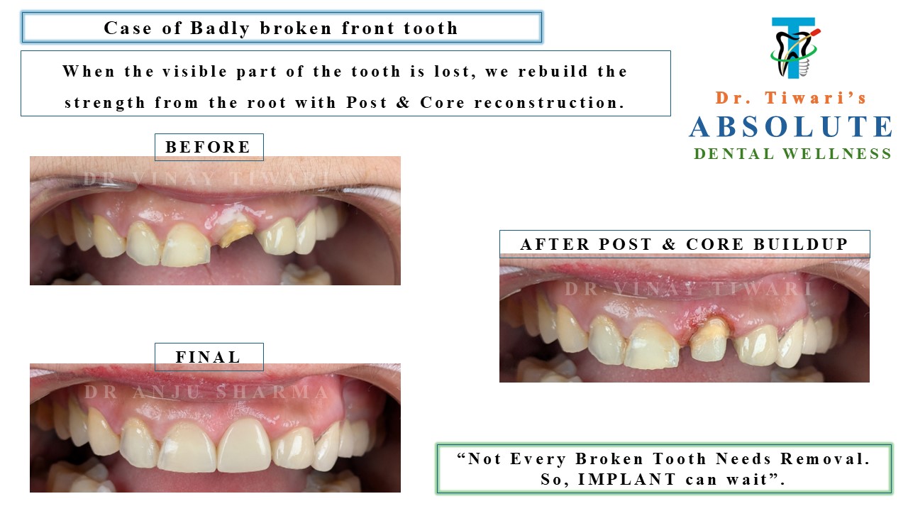 Before & After Clinical Case 7