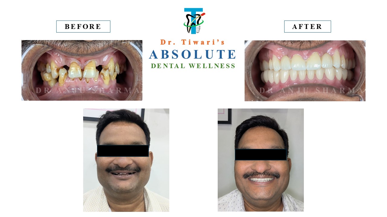 Before & After Clinical Case 8