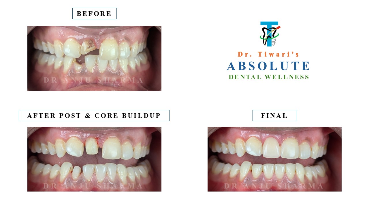 Before & After Clinical Case 9