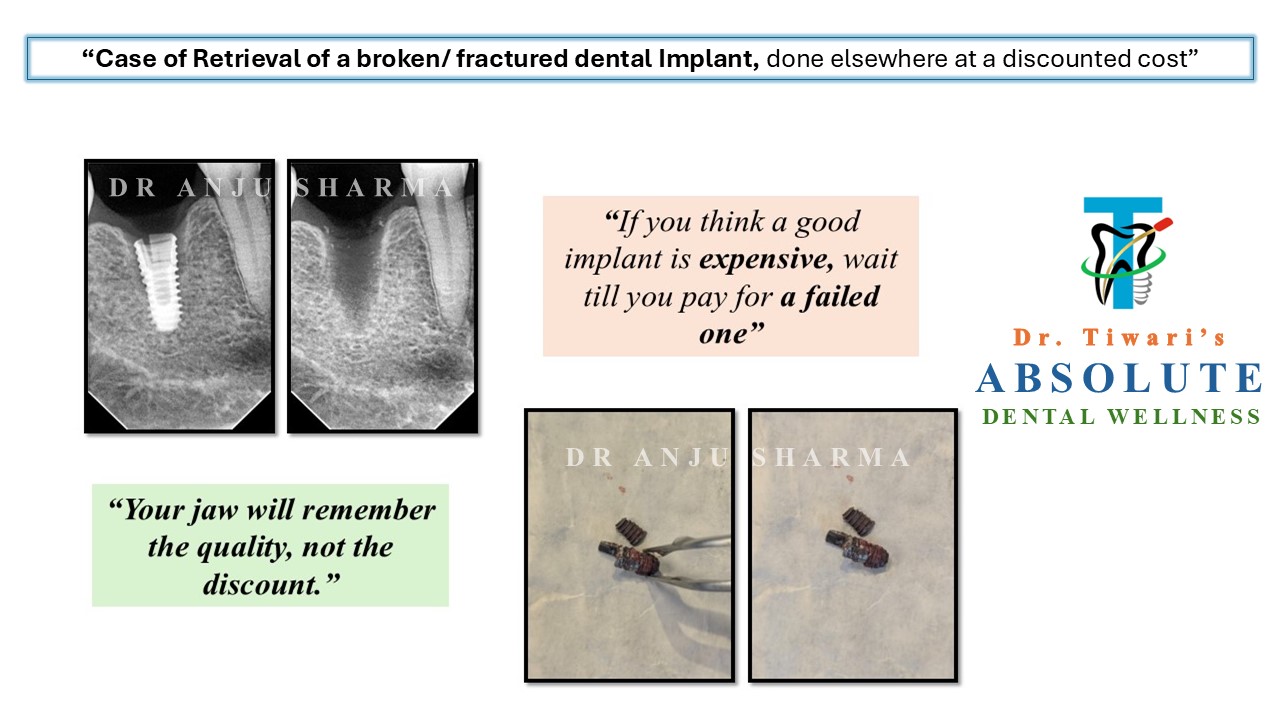 Before & After Clinical Case 10